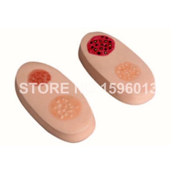 Variola Lesion Modules, Smallpox Simulator Skin Model, Nursing Practice Model
