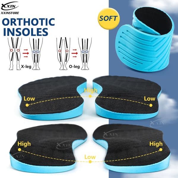 XxinMen Women X leg Correction Insoles Orthopedic Shoe Pads O leg Insole Flat Arch Shoe Inserts Size 35- 260525