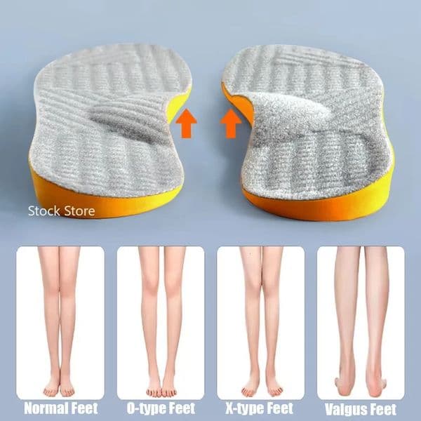 Arch Support Flat Foot Orthopedic Insoles for Shoes Women Men Children X/O Type Legs Valgus Feet Correction Sports Shoe Pads 260331