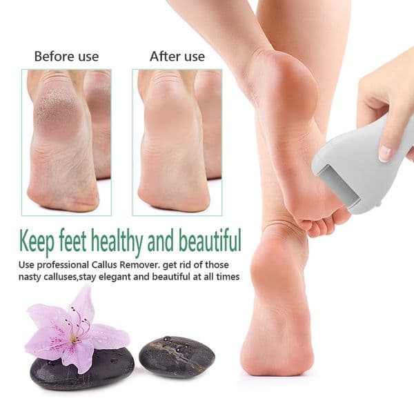 NEW ARRIVING Foot care tool Heads Pedicure Hard Dead Skin Remover Refills Replacement Rollers For File Feet care Tools