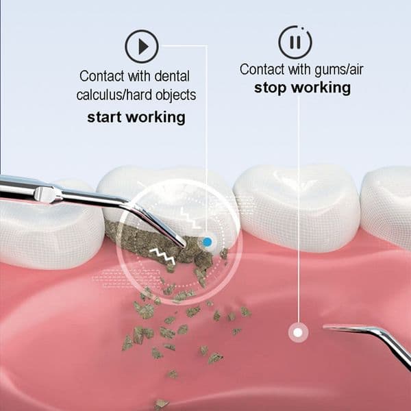 Xiaomi Youpin Dental Calculus Removal Ultrasonic Dental Calculus Scaler Smart Dental Tartar Remover Electric Sonic Teeth Cleaner