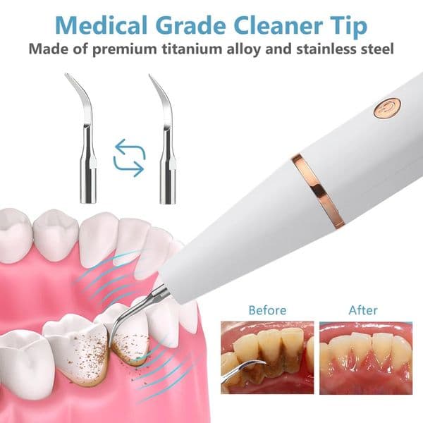 Electric Dental Calculus Remover, Household Irrigator for Teeth Dental Ultrasound Stains Teeth Polishing