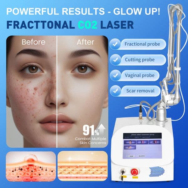 Desktop CO2 Fractional Laser Skin Treatment Machine for Anti-Wrinkle Acne Scar Removal and Skin Resurfacing