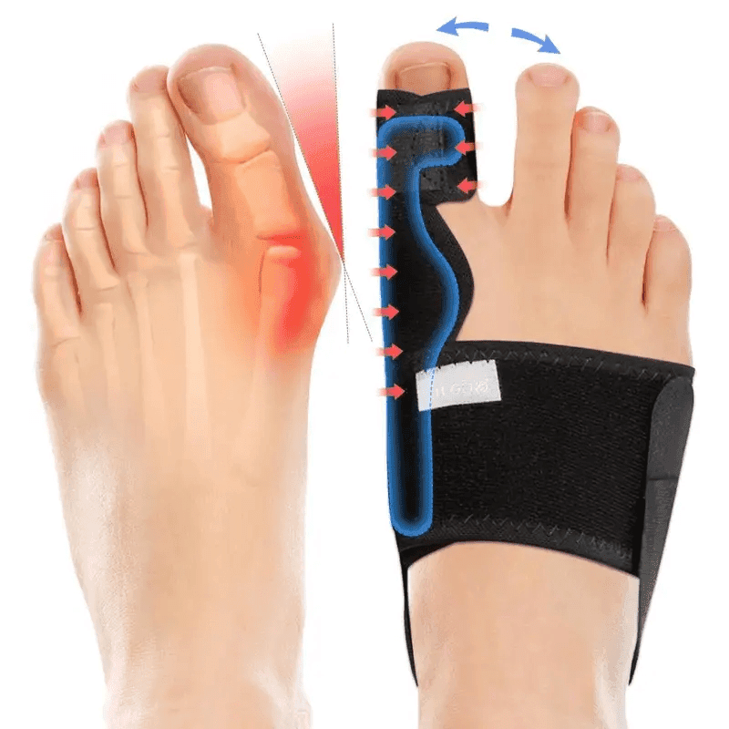TEMU 2026 New Pad Big Toe: Foot Straightener Splint Brace 2pcs