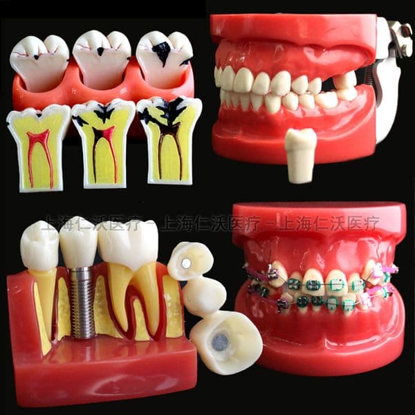 Various Dental Teeth Models Are Used For Teaching And Hospital Dentist Material