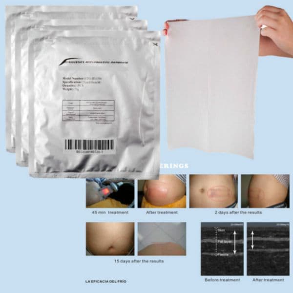 Beauty Equipment Anti Freezing Membranes For Fat Machines Lot Antifreeze Membrane 0.07G Bag 110G Cooling Therapy Pad304